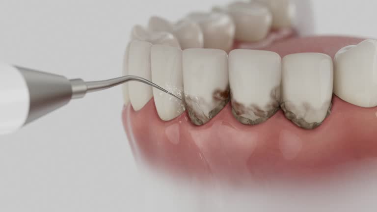 Reliable Dental Implants contractor in Elba, AL by Smile Center Dentistry